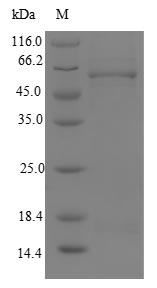 Recombinant Human Malonyl-CoA decarboxylase, mitochondrial(MLYCD)
