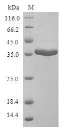 Recombinant Human Mammaglobin-A(SCGB2A2)