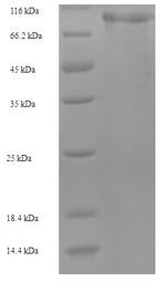 Recombinant Human Mannan-binding lectin serine protease 1(MASP1)