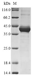 Recombinant Human Maternal embryonic leucine zipper kinase(MELK),partial