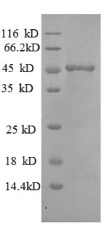 Recombinant Human Matrilysin(MMP7)