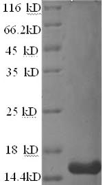 Recombinant Human Matrix Gla protein(MGP)
