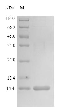 Recombinant Human Matrix Gla protein(MGP)