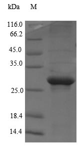 Recombinant Human Mediator of RNA polymerase II transcription subunit 1(MED1),partial