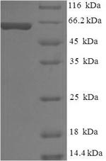 Recombinant Human Melanocyte protein PMEL(PMEL)，partial