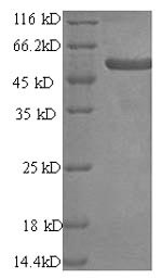 Recombinant Human Melanoma antigen preferentially expressed in tumors(PRAME)