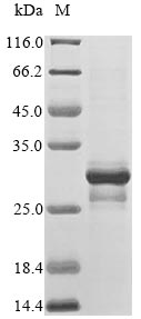 Recombinant Human Melanoma antigen recognized by T-cells 1(MLANA)