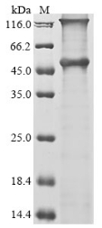 Recombinant Human Melanoma-associated antigen 12(MAGEA12)