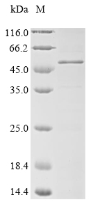 Recombinant Human Melanoma-associated antigen 3(MAGEA3)