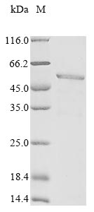 Recombinant Human Melanoma-associated antigen 4(MAGEA4)(A173T)