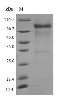 Recombinant Human Membrane cofactor protein(CD46) (Active)