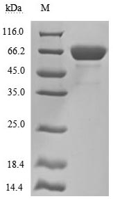 Recombinant Human Mesothelin(MSLN),partial (Active)