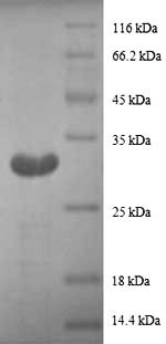 Recombinant Human Metallothionein-1G(MT1G),partial