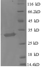 Recombinant Human Metallothionein-1X(MT1X),partial