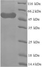 Recombinant Human Methylosome protein 50(WDR77),partial
