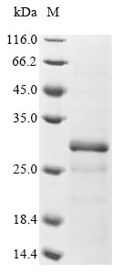 Recombinant Human Methyltransferase-like protein 7B(METTL7B)