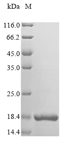 Recombinant Human Microtubule-associated serine/threonine-protein kinase 4(MAST4),partial
