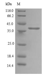 Recombinant Human Mitochondrial import inner membrane translocase subunit TIM14(DNAJC19)