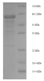 Recombinant Human Mitogen-activated protein kinase 9(MAPK9)