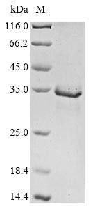 Recombinant Human Mitogen-activated protein kinase kinase kinase 14(MAP3K14),partial