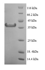 Recombinant Human Mitotic spindle assembly checkpoint protein MAD2A(MAD2L1)