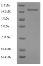 Recombinant Human Mixed lineage kinase domain-like protein(MLKL)