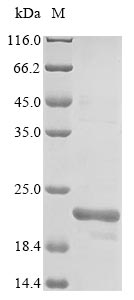 Recombinant Human Monocarboxylate transporter 5(SLC16A4),partial