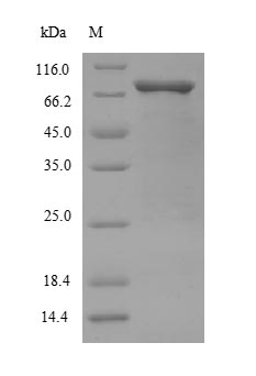 Recombinant Human Mothers against decapentaplegic homolog 2(SMAD2)