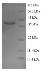 Recombinant Human Mucin-2(MUC2),partial