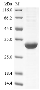 Recombinant Human Mucin-2(MUC2),partial