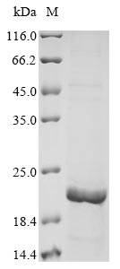 Recombinant Human Mucin-5B(MUC5B),partial