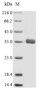 Recombinant Human Multidrug resistance-associated protein 1 (ABCC1),partial