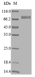 Recombinant Human Myeloid cell surface antigen CD33(CD33),partial (Active)