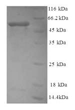 Recombinant Human Myosin-9(MYH9) ,partial