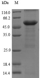 Recombinant Human Myosin-binding protein C, cardiac-type(MYBPC3),partial