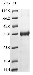 Recombinant Human Myosin light chain kinase, smooth muscle(MYLK),partial