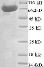 Recombinant Human N-acetylmuramoyl-L-alanine amidase(PGLYRP2)