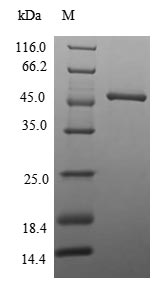 Recombinant Human N-terminal Xaa-Pro-Lys N-methyltransferase 1(NTMT1) (Active)