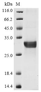Recombinant Human NACHT, LRR and PYD domains-containing protein 3(NLRP3),partial
