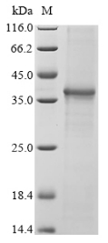 Recombinant Human NACHT, LRR and PYD domains-containing protein 3(NLRP3),partial