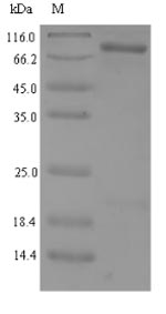 Recombinant Human NAD-dependent protein deacetylase sirtuin-1(SIRT1)