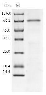 Recombinant Human NAD-dependent protein deacetylase sirtuin-6(SIRT6)