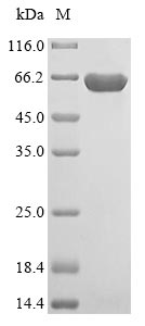 Recombinant Human NADP-dependent malic enzyme, mitochondrial(ME3),partial