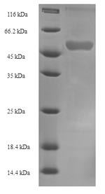 Recombinant Human NADPH:adrenodoxin oxidoreductase, mitochondrial(FDXR)
