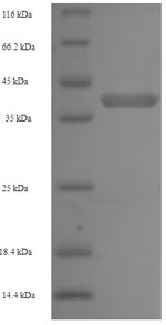 Recombinant Human Napsin-A(NAPSA)