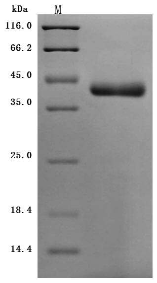 Recombinant Human Nectin-4(NECTIN4),partial (Active)