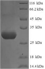 Recombinant Human Nephrin(NPHS1) ,partial