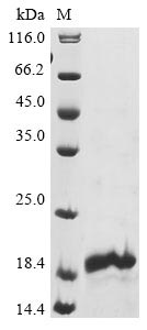 Recombinant Human Neuron navigator 1(NAV1),partial