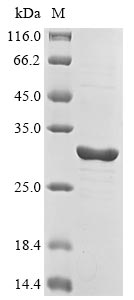 Recombinant Human Neuronal acetylcholine receptor subunit beta-2(CHRNB2),partial