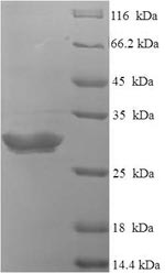 Recombinant Human Neurotensin/neuromedin N(NTS) ,partial
